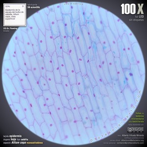 Epidermis Epidermis
